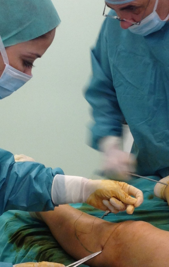 Varices, el mejor tratamiento vascular para cada paciente Doctora Ana